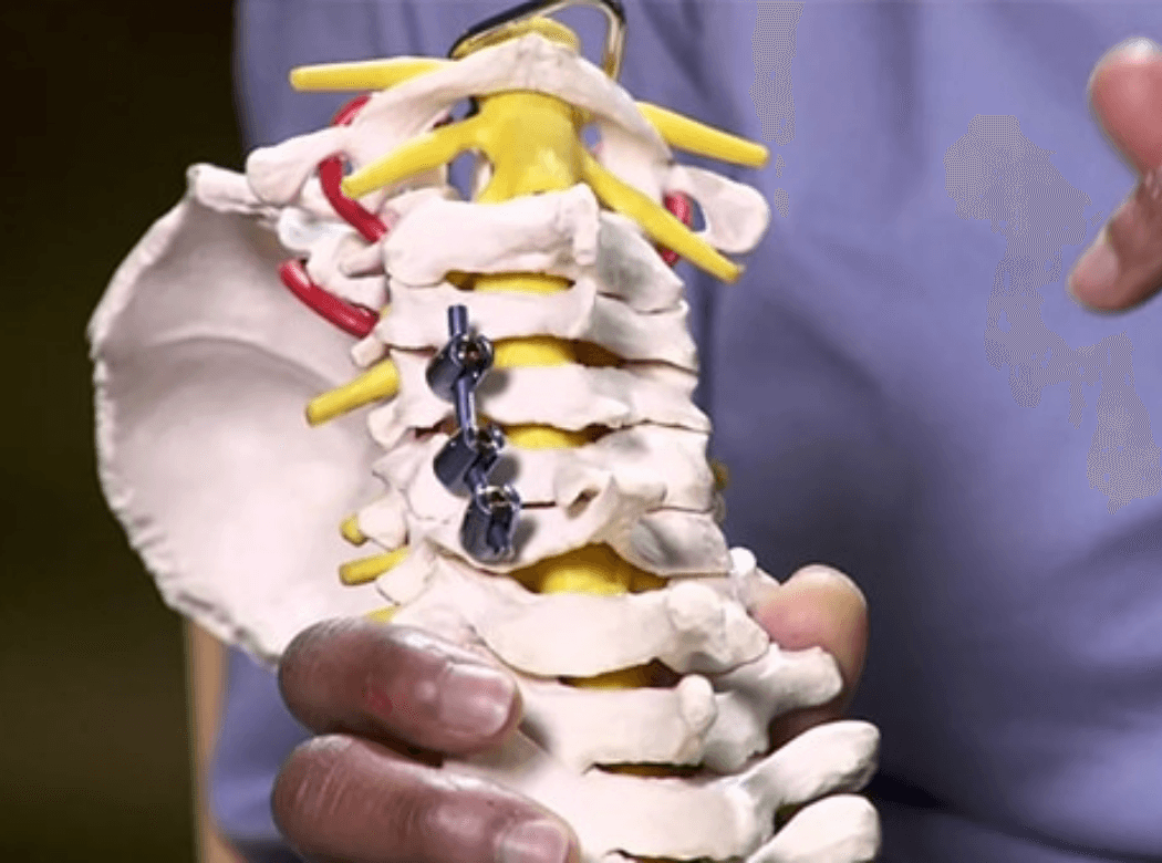 Surgical team performing a vertebroplasty procedure