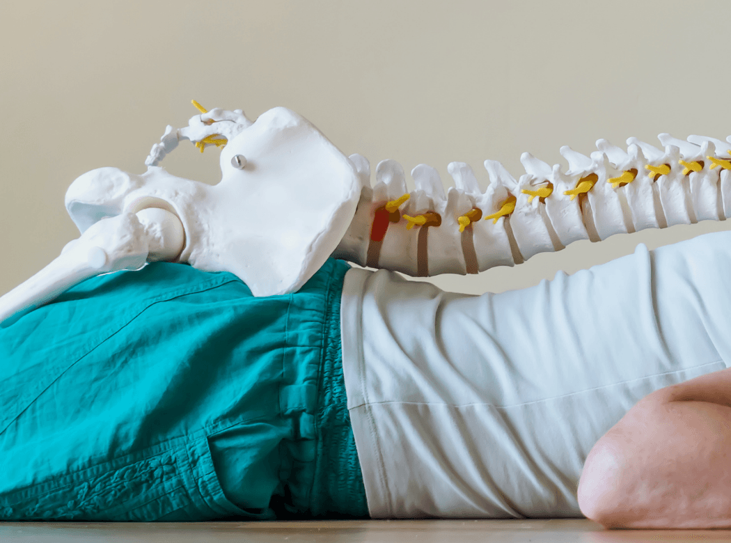 Illustration of spinal decompression relieving pressure on a compressed nerve
