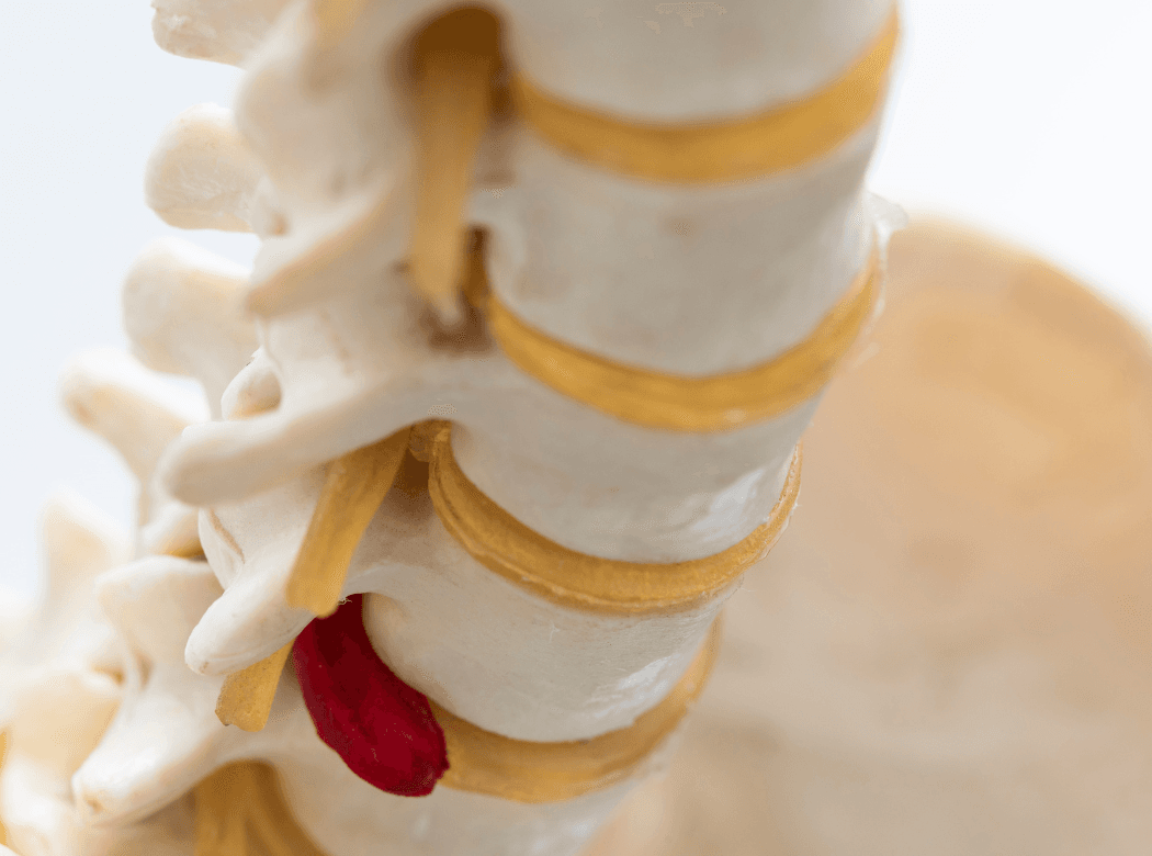 Surgical team performing a vertebroplasty procedure