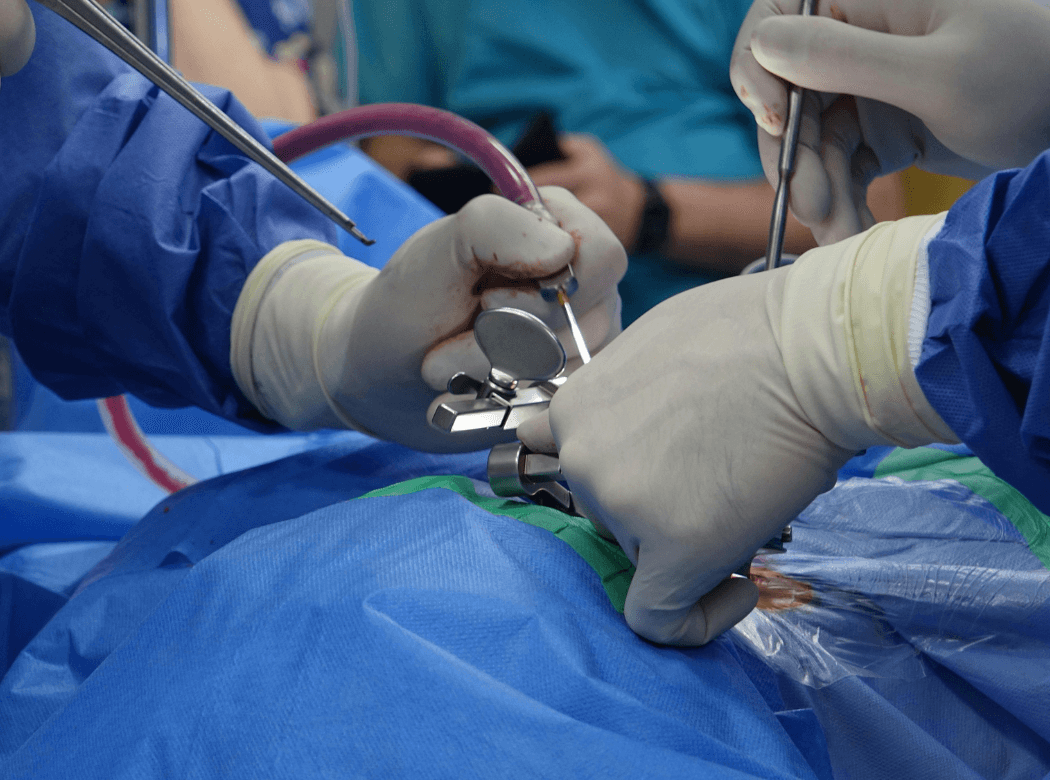 Surgical team performing a spinal stenosis decompression procedure